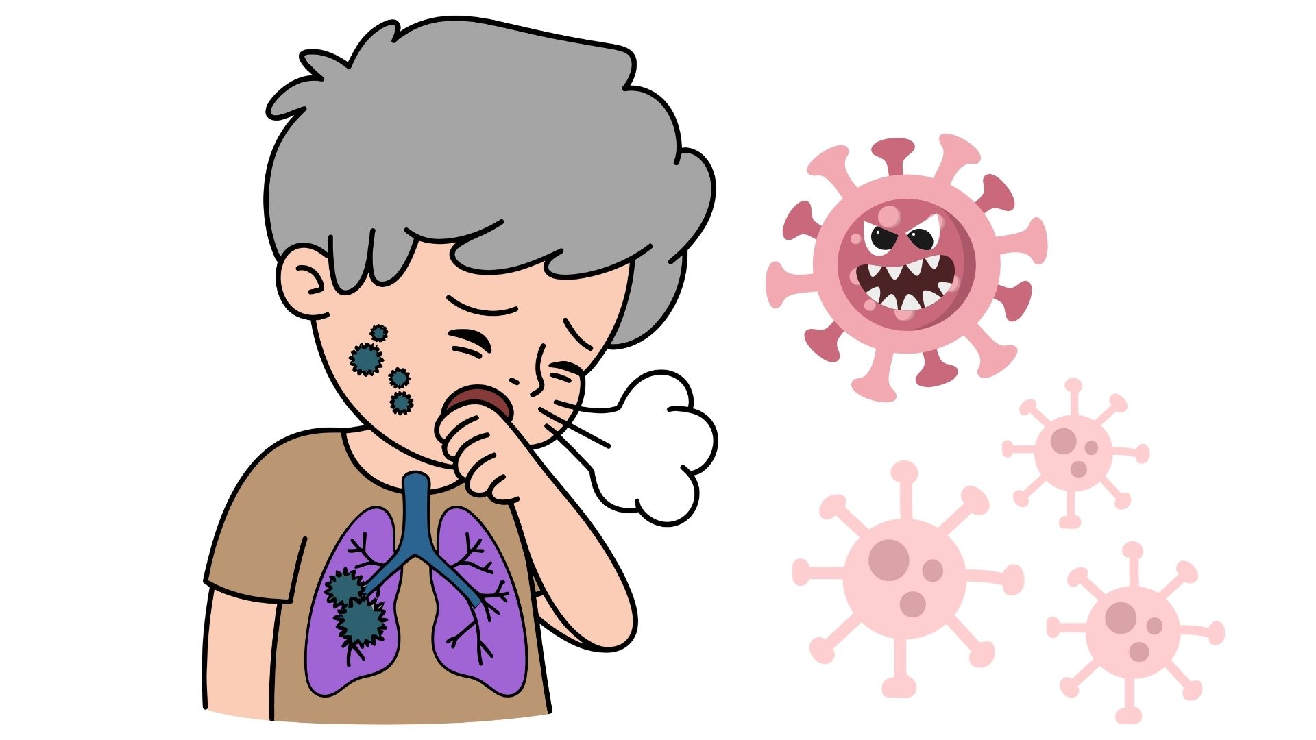 Memahami Fenomena Super Flu: Ancaman Varian H3N2 di Indonesia